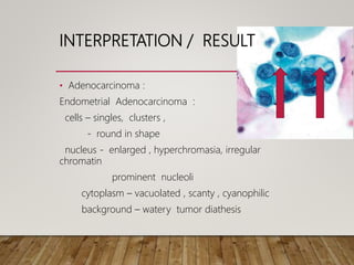 INTERPRETATION / RESULT
• Adenocarcinoma :
Endometrial Adenocarcinoma :
cells – singles, clusters ,
- round in shape
nucleus - enlarged , hyperchromasia, irregular
chromatin
prominent nucleoli
cytoplasm – vacuolated , scanty , cyanophilic
background – watery tumor diathesis
 