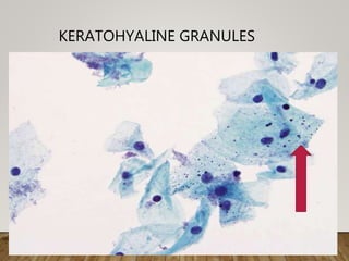 KERATOHYALINE GRANULES
 