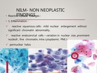 NILM- NON NEOPLASTIC
FINDINGS• Reactive cellular changes :
• 1. Inflammation :
 reactive squamous cells- mild nuclear enlargement without
significant chromatin abnormality .
 reactive endocervical cells – variation in nuclear size, prominent
nucleoli , fine chromatin, intra cytoplasmic PML’s
 perinuclear halos
 