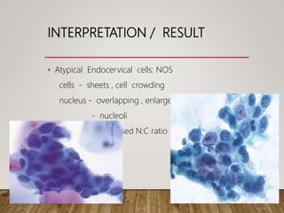 INTERPRETATION / RESULT
• Atypical Endocervical cells: NOS
cells - sheets , cell crowding
nucleus - overlapping , enlarged ,pleomorphism
- nucleoli
- increased N:C ratio
 