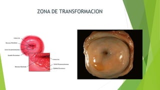 ZONA DE TRANSFORMACION
 