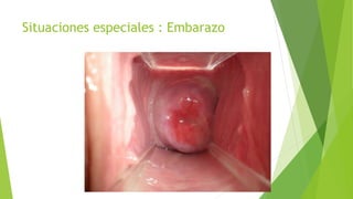 Situaciones especiales : Embarazo
 