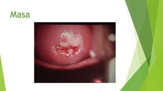 Masa
 