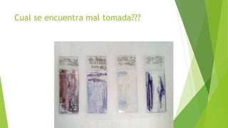 Cual se encuentra mal tomada???
 