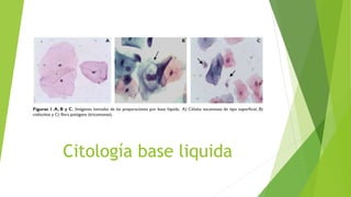 Citología base liquida
 