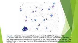 Figura 1.4 Celularidad escamosa satisfactoria, pero limítrofe (LBP ThinPrep) campo10X
La muestra debe tener al menos este nivel de celularidad para ser considerado satisfactorio, a
40X aproximadamente cuatro células por campo, lo que correspondería a poco más de 5.000
células. Tenga en cuenta que este nivel de densidad celular sería insatisfactorio en un SurePath
 