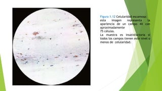 Figura 1.12 Celularidad escamosa:
esta imagen representa la
apariencia de un campo 4X con
aproximadamente
75 células.
La muestra es insatisfactoria si
todos los campos tienen este nivel o
menos de celularidad.
 