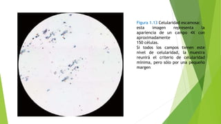 Figura 1.13 Celularidad escamosa:
esta imagen representa la
apariencia de un campo 4X con
aproximadamente
150 células.
Si todos los campos tienen este
nivel de celularidad, la muestra
reunirá el criterio de celularidad
mínima, pero sólo por una pequeño
margen
 