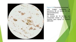 Figura 1.14 Celularidad escamosa:
esta imagen representa la
apariencia de un campo 4X con
aproximadamente
500 células.
Un mínimo de 16 campos con
celularidad similar (o mayor) se
necesita para llamar la muestra
adecuada
 
