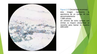 Figura 1.15 Celularidad escamosa:
esta imagen representa la
apariencia de un campo 4X con
aproximadamente
1,000 células.
Un mínimo de ocho campos con
similar (o mayor) celularidad se
necesita para llamar la muestra
adecuada
 