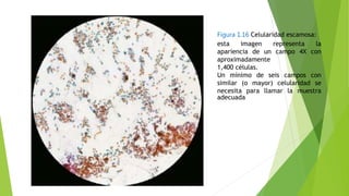 Figura 1.16 Celularidad escamosa:
esta imagen representa la
apariencia de un campo 4X con
aproximadamente
1,400 células.
Un mínimo de seis campos con
similar (o mayor) celularidad se
necesita para llamar la muestra
adecuada
 