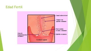 Edad Fertil
 