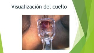 Visualización del cuello
 