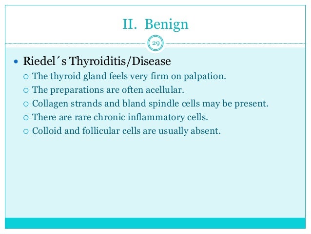 Riedel stroma thyroid