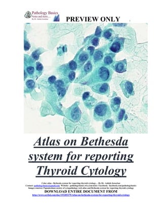 PREVIEW ONLY

1

Atlas on Bethesda
system for reporting
Thyroid Cytology
Color atlas - Bethesda system for reporting thyroid cytology… By Dr. Ashish Jawarkar
Contact: pathologybasics@gmail.com Website: pathologybasics.wix.com/notes Facebook: facebook.com/pathologybasics
Images courtesy Papanicolaou society of cytopathology web atlas and Bethesda system for reporting thyroid cytology

DOWNLOAD ENTIRE DOCUMENT FROM
http://www.scribd.com/doc/193205279/Atlas-on-bethesda-system-for-reporting-thyroid-cytology

 