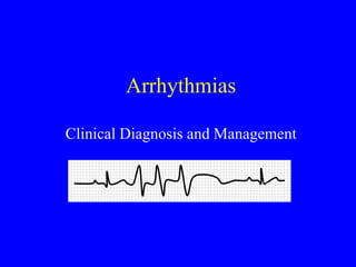 Arrhythmias
Clinical Diagnosis and Management
 