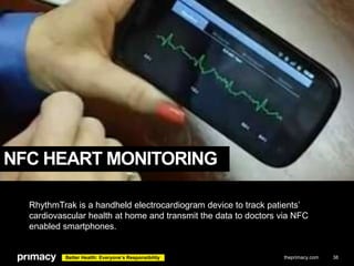 NFC HEART MONITORING
RhythmTrak is a handheld electrocardiogram device to track patients’
cardiovascular health at home an...