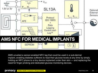 AMS NFC FOR MEDICAL IMPLANTS

AMS unveiled a sensor-enabled NFC tag that could be used in a sub-dermal
implant, enabling d...