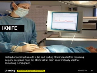 IKNIFE

Instead of sending tissue to a lab and waiting 30 minutes before resuming
surgery, surgeons hope the iKnife will l...