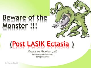 Post LASIK Ectasia
Dr/Marwa Abdellah , MD
Lecturer of ophthalmology
Sohag University
Beware of the
Monster !!!
Dr/ Marwa Abdellah
 