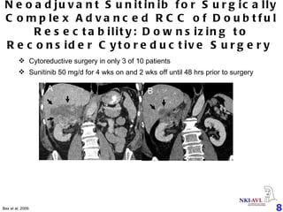 Neoadjuvant Sunitinib for Surgically Complex Advanced RCC of Doubtful Resectability: Downsizing to Reconsider Cytoreductive Surgery   Cytoreductive surgery in only 3 of 10 pati ents Sunitinib 50 mg/d  for 4 wks on and 2 wks off  until 48 hrs prior to surgery Bex  et al,  2009.  