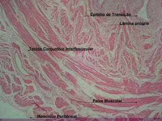 Epitélio de Transição Lâmina própria Feixe Muscular Tecido Conjuntivo Interfascicular Mesotélio Peritôneal 