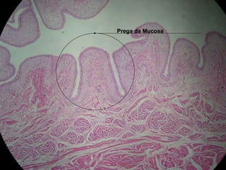 Prega da Mucosa Prega da Mucosa