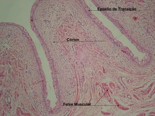 Epitélio de Transição Córion Feixe Muscular