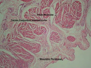 Feixe Muscular Tecido Conjuntivo Interfascicular Mesotélio Peritôneal