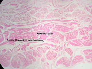 Feixe Muscular Tecido Conjuntivo Interfascicular