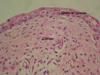 Epitélio de Transição Córion