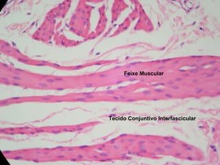 Feixe Muscular Tecido Conjuntivo Interfascicular