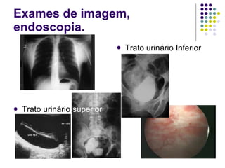 Exames de imagem, endoscopia. Trato urinário  superior Trato urinário Inferior 