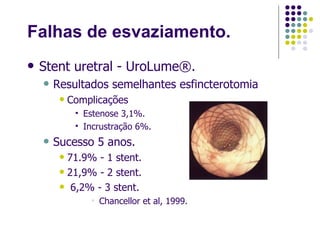 Falhas de esvaziamento. Stent uretral - UroLume®. Resultados semelhantes esfincterotomia Complicações  Estenose 3,1%. Incrustração 6%.  Sucesso 5 anos. 71.9% - 1 stent. 21,9% - 2 stent. 6,2% - 3 stent. Chancellor et al, 1999. 