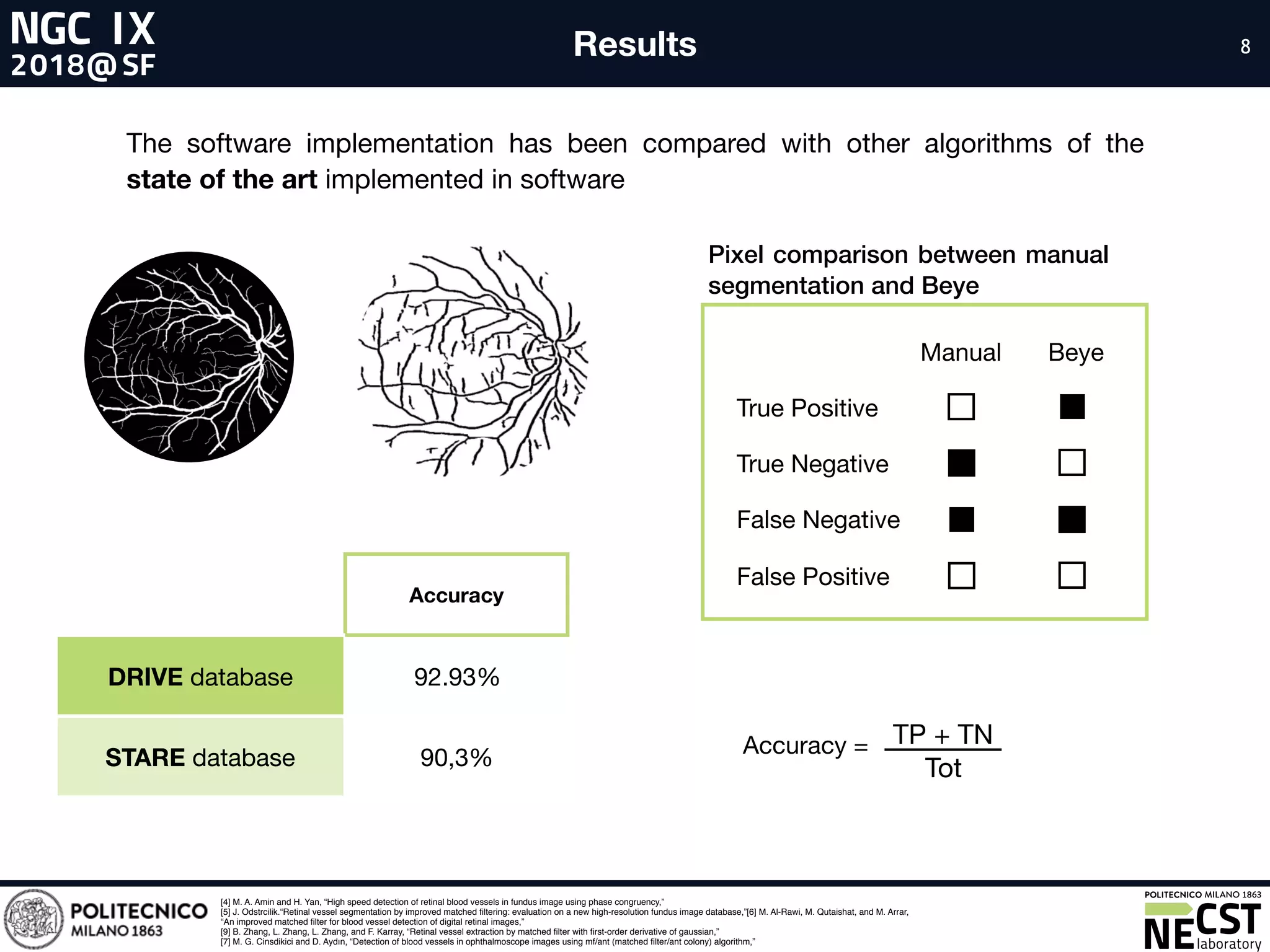 8Results 8
Accuracy
DRIVE database 92.93%
STARE database 90,3%
[4] M. A. Amin and H. Yan, “High speed detection of retinal blood vessels in fundus image using phase congruency,”
[5] J. Odstrcilik.“Retinal vessel segmentation by improved matched ﬁltering: evaluation on a new high-resolution fundus image database,”[6] M. Al-Rawi, M. Qutaishat, and M. Arrar,
“An improved matched ﬁlter for blood vessel detection of digital retinal images,”
[9] B. Zhang, L. Zhang, L. Zhang, and F. Karray, “Retinal vessel extraction by matched ﬁlter with ﬁrst-order derivative of gaussian,”
[7] M. G. Cinsdikici and D. Aydın, “Detection of blood vessels in ophthalmoscope images using mf/ant (matched ﬁlter/ant colony) algorithm,”
TP + TN

Tot
Accuracy =
BeyeManual
True Positive
True Negative
False Negative
False Positive
Pixel comparison between manual
segmentation and Beye
The software implementation has been compared with other algorithms of the
state of the art implemented in software
 
