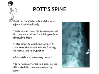 Destruction of intervetebral disc and
adjacent vertebral body
-Early course there will be narrowing of
disc space + erosion of adjoining surface
of vertebral body.
-Later, bone destruction may lead to
collapse of the vertebral body, forming
the gibbus (sharp angulations)
-Paravetebral abscess may present
-Bony fusion of vertebral bodies across
obliterated disc space when healing
occurs
POTT’S SPINE
 