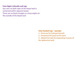 False Rigler's/double wall sign
Gas seen on both sides of the bowel wall is
contained within adjacent bowel
There are no black triangles or sharp angles on
the outside of the bowel wall
False football sign - example
1 - Perirenal fat (retroperitoneal)
2 - Peritoneal fat (next to the liver)
3 - Abdominal wall fat (separating muscles of
the abdominal wall)
 