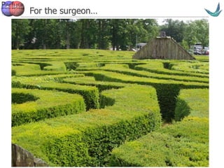 Vascular surgery @ Tallaght
For the surgeon…
 