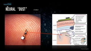 Neural ‘dust’ UC Berkley
©lucienengelen
 