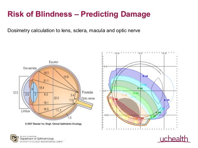 download free beyond eye care target download free beyond eye care target