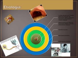 La falta del píloro por Cirugías
gástricas producen una
evacuación rápida y el bezoar
entonces se encuentra en
intestino delgado.
Medicamentos que alteran la
evacuación gástrica: opioides,
antivomitivos, atropina.

Distrofia muscular

Neuropatía alcohólica

Gastroparesia diabética.

 