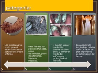 • Los tricobezoares,
por lo general
están compuestos
por pelo del propio
enfermo;

• otras fuentes son
pelos de muñecas,
pelos
• de animales, pelos
de alfombras,
tapetes y
• frazadas .

• . pueden crecer
con lentitud
durante muchos
años, y formar un
molde del
estómago y
prolongarse al
intestino.

• Se considera la
longitud del cabello
como un factor de
gran importancia
en la formación del
bezoar.

 