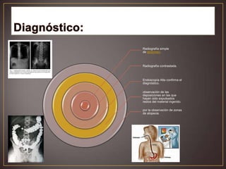 Radiografía simple
de abdomen.

Radiografía contrastada.

Endoscopía Alta confirma el
diagnóstico.
observación de las
deposiciones en las que
hayan sido expulsados
restos del material ingerido.
por la observación de zonas
de alopecia.

 