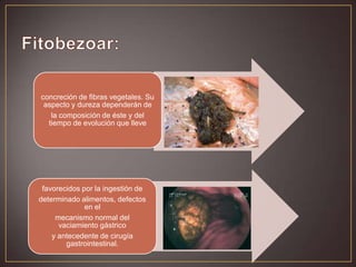concreción de fibras vegetales. Su
aspecto y dureza dependerán de
la composición de éste y del
tiempo de evolución que lleve

favorecidos por la ingestión de
determinado alimentos, defectos
en el
mecanismo normal del
vaciamiento gástrico
y antecedente de cirugía
gastrointestinal.

 