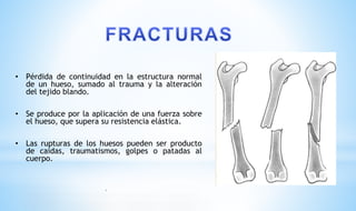 • Pérdida de continuidad en la estructura normal
de un hueso, sumado al trauma y la alteración
del tejido blando.
• Se produce por la aplicación de una fuerza sobre
el hueso, que supera su resistencia elástica.
• Las rupturas de los huesos pueden ser producto
de caídas, traumatismos, golpes o patadas al
cuerpo.
•
 