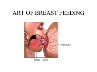 ART OF BREAST FEEDING
 