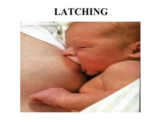 LATCHING
 