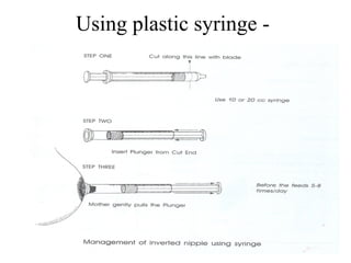 Using plastic syringe -
 