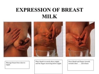 EXPRESSION OF BREAST
MILK
Massage breast from chest to
nipple
Place thumb on areola above nipple,
and the fingers encircling below nipple
Press thumb and fingers inwards
towards chest…….and release
 