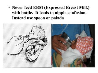 • Never feed EBM (Expressed Breast Milk)
with bottle. It leads to nipple confusion.
Instead use spoon or palada
 